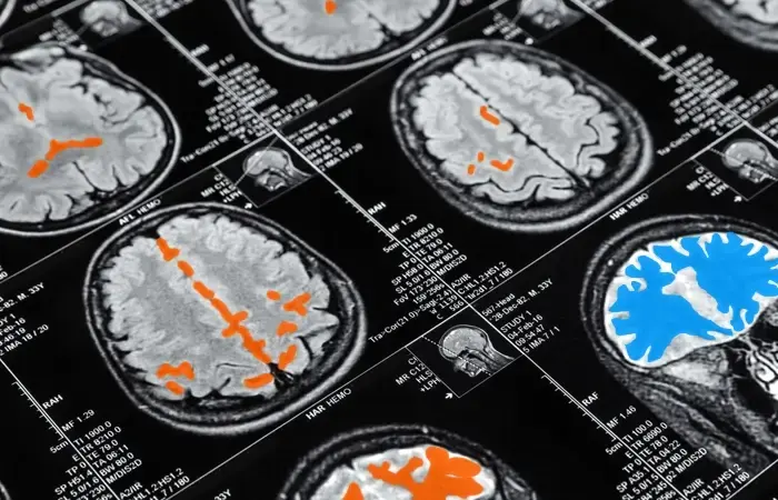 Medical Data Annotation Services